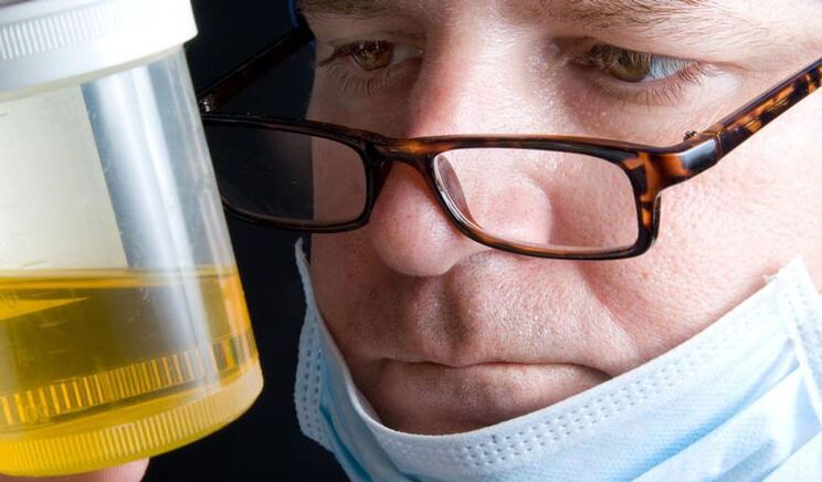 analiza urina za kronični prostatitis